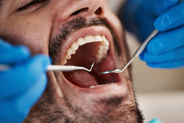 Best Dental Abscess Treatment in Iron Mountain, MI